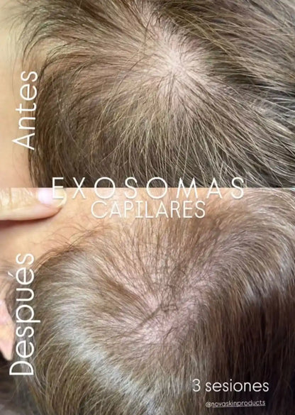 Hair_Exosome_Dermik, Example